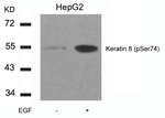 Phospho-Cytokeratin 8 (Ser74) Antibody in Western Blot (WB)