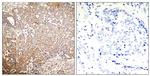 Phospho-Cytokeratin 18 (Ser33) Antibody in Immunohistochemistry (Paraffin) (IHC (P))