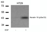 Phospho-Cytokeratin 18 (Ser33) Antibody in Western Blot (WB)