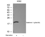Phospho-Stathmin 1 (Ser38) Antibody in Western Blot (WB)