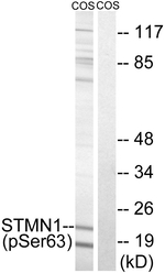 Phospho-Stathmin 1 (Ser63) Antibody in Western Blot (WB)