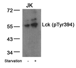 Phospho-LCK (Tyr394) Antibody in Western Blot (WB)