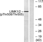 Phospho-LIMK1 (Thr508) Antibody in Western Blot (WB)