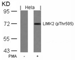 Phospho-LIMK2 (Thr505) Antibody in Western Blot (WB)