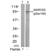 Phospho-MARCKS (Ser158) Antibody in Western Blot (WB)