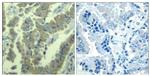 Phospho-MARCKS (Ser170) Polyclonal Antibody