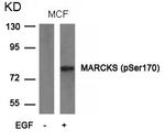 Phospho-MARCKS (Ser170) Antibody in Western Blot (WB)