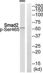 Phospho-SMAD2 (Ser465) Antibody in Western Blot (WB)
