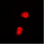 Phospho-SMAD2 (Thr220) Polyclonal Antibody