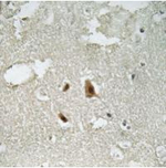 Phospho-SMAD2 (Thr220) Antibody in Immunohistochemistry (Paraffin) (IHC (P))