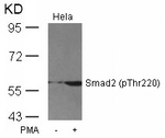 Phospho-SMAD2 (Thr220) Antibody in Western Blot (WB)