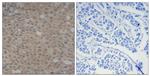 Phospho-SMAD3 (Ser425) Polyclonal Antibody