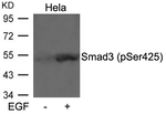 Phospho-SMAD3 (Ser425) Antibody in Western Blot (WB)