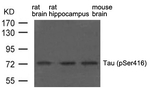 Phospho-Tau (Ser416) Antibody in Western Blot (WB)
