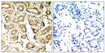 Phospho-MEF2A (Ser408) Polyclonal Antibody