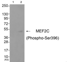 Phospho-MEF2C (Ser396) Antibody in Western Blot (WB)