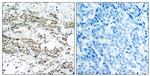 Phospho-FOXO4 (Ser197) Antibody in Immunohistochemistry (Paraffin) (IHC (P))