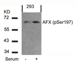Phospho-FOXO4 (Ser197) Antibody in Western Blot (WB)