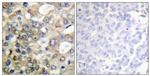 Phospho-MUC1 (Tyr1229) Antibody in Immunohistochemistry (Paraffin) (IHC (P))