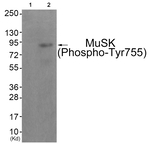 Phospho-MUSK (Tyr755) Antibody in Western Blot (WB)
