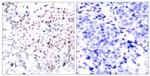 Phospho-c-Myc (Thr358) Antibody in Immunohistochemistry (Paraffin) (IHC (P))