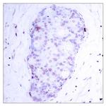 Phospho-NFkB p105 (Ser907) Polyclonal Antibody