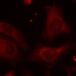 Phospho-NFkB p105 (Ser927) Polyclonal Antibody