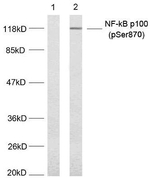 Phospho-NFkB p100 (Ser870) Antibody in Western Blot (WB)