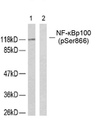 Phospho-NFkB p100 (Ser866) Antibody in Western Blot (WB)