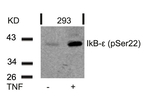 Phospho-IkB epsilon (Ser22) Antibody in Western Blot (WB)