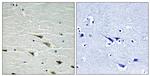 Phospho-TrkA (Tyr757) Antibody in Immunohistochemistry (Paraffin) (IHC (P))