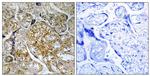 Phospho-PAK1 (Ser199) Antibody in Immunohistochemistry (Paraffin) (IHC (P))