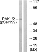 Phospho-PAK1 (Ser199) Antibody in Western Blot (WB)