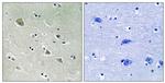 Phospho-PAK1 (Ser204) Antibody in Immunohistochemistry (Paraffin) (IHC (P))