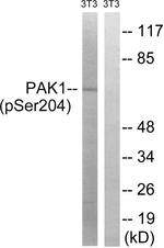 Phospho-PAK1 (Ser204) Antibody in Western Blot (WB)