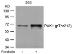 Phospho-PAK1 (Thr212) Antibody in Western Blot (WB)