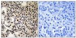 Phospho-PAK2 (Ser197) Polyclonal Antibody