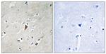 Phospho-PDPK1 (Tyr9) Antibody in Immunohistochemistry (Paraffin) (IHC (P))