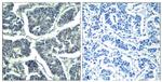 Phospho-PLCG2 (Tyr1217) Polyclonal Antibody