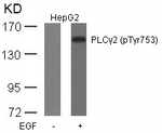 Phospho-PLCG2 (Tyr753) Antibody in Western Blot (WB)