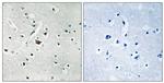 Phospho-PLD2 (Tyr169) Polyclonal Antibody