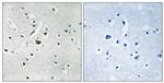 Phospho-PLD2 (Tyr169) Antibody in Immunohistochemistry (Paraffin) (IHC (P))