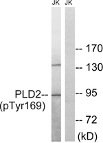 Phospho-PLD2 (Tyr169) Antibody in Western Blot (WB)