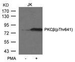 Phospho-PKC beta (Thr641) Antibody in Western Blot (WB)