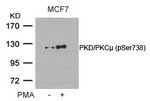 Phospho-PKC mu (Ser738) Antibody in Western Blot (WB)
