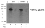 Phospho-PKC mu (Ser910) Antibody in Western Blot (WB)