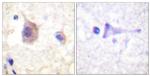 Phospho-PKC mu (Tyr463) Polyclonal Antibody