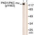 Phospho-PKC mu (Tyr463) Antibody in Western Blot (WB)