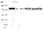 Phospho-PKC theta (Ser676) Antibody in Western Blot (WB)