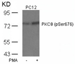 Phospho-PKC theta (Ser676) Antibody in Western Blot (WB)